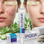 BioAqua Acne Removal Cream