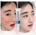 BioAqua Acne Removal Cream - Image 2